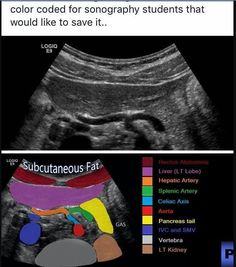 an x - ray shows the color code for songary students that would like to save it