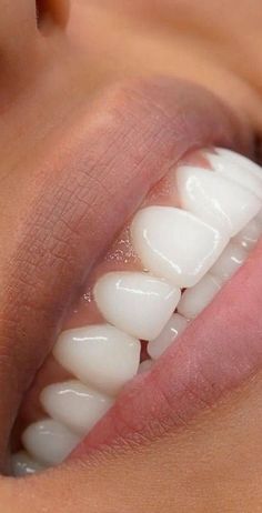 Loose Tooth, Yellow Teeth, Stronger Teeth, Receding Gums