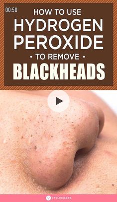 To Remove Blackheads, Diy Skin Care Routine, Remove Blackheads, Homecoming Nails Acrylic, Get Rid Of Blackheads, Skin Care Order, Skincare Organization, Makeup Looks For Brown Eyes, Skin Care Items