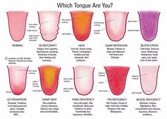 Tongue diagnosis is a method in Chinese Medicine for understanding what's happening inside the body—sort of like an “MRI” Autogenic Training, Running Tips, Traditional Chinese Medicine, Reflexology, Health Info, Chinese Medicine, Acupressure, Natural Medicine