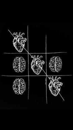 four brain sections are connected to wires in the shape of heart and crosshairs