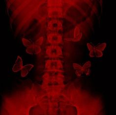 the back of a skeleton with butterflies on it's ribs in red and black