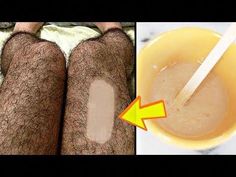 unwanted hair removal With this Diy Hair removal Treatment. Hair removal at home with this mixture. Learn how to get rid of facial hair naturally at home. Re... Permanent Hair Removal At Home, Natural Hair Removal Remedies, Hair Removal Diy, Remove Unwanted Hair