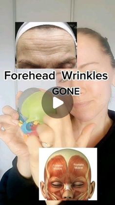 How To Get Rid Of Deep Forehead Wrinkles, Taping Forehead Wrinkles, Face Taping For Wrinkles Lines, Face Yoga For Forehead Wrinkles, Forehead Wrinkles Exercises, Face Yoga Forehead Wrinkles, Forehead Wrinkles Massage, Massage For Forehead Wrinkles, Deep Wrinkles Forehead