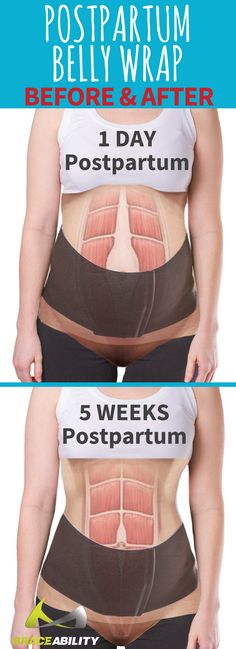 Wear this wrap for FAST postpartum recovery! This abdominal binder helps protect and hold your stomach muscles together accelerating postnatal healing. The soft belly bandage is made of a low-file, moisture-wicking foam fabric, which is breathable, sweat-resistant, neoprene and latex free. It applies gentle compression to support your back and abdomen after pregnancy. Soft Belly, Post Partum Belly Wrap, Skin Bumps, Belly Wrap, Postpartum Belly, Diet Plans For Women