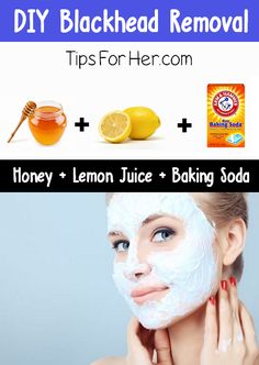 DIY Blackhead Removal - An insanely easy tip to remove black heads. All you need is 3 items you probably already have in your kitchen. Clear Skin Naturally, Blackheads On Nose, Black Heads, Blackhead Removal, Get Rid Of Blackheads, Homemade Diy, Pregnancy Health, Homemade Face Masks