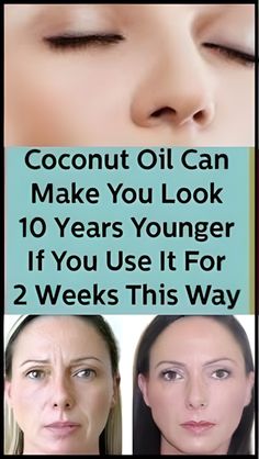 Coconut Oil Can Make You Look 10 Years Younger If You Use It For 2 Weeks This Way Diy Anti Aging Cream, Wrinkles Remedies Face, Dark Spots Remedies, Get Rid Of Wrinkles, Eye Wrinkles, Anti Aging Skincare Routine, Wrinkle Remedies, Wrinkle Free Skin, Diy Beauty Treatments