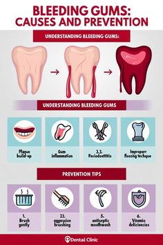 "Learn about the essential daily routine for maintaining stronger and healthier gums. Discover effective oral care practices and natural tips for gum strength." Tags: #HealthyGums #DailyOralCare #StrongerGums #GumHealth #NaturalRemedies Family Dental Care, Gum Inflammation, Strengthen Teeth, Teeth Health, How To Prevent Cavities, Family Dental, Hygiene Routine, Gum Health, Natural Teeth