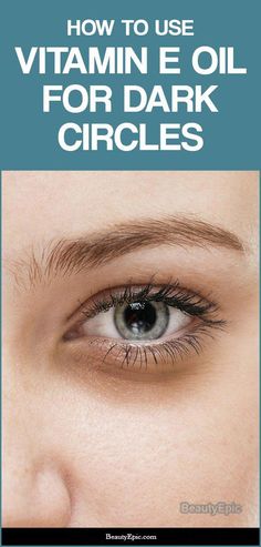 Vitamins For Dark Eye Circles, Vitamin E For Dark Circles Under Eyes, Vitamin E Oil Uses, Dark Circles Makeup, Natural Eye Cream, Medical Tips, Makeover Tips