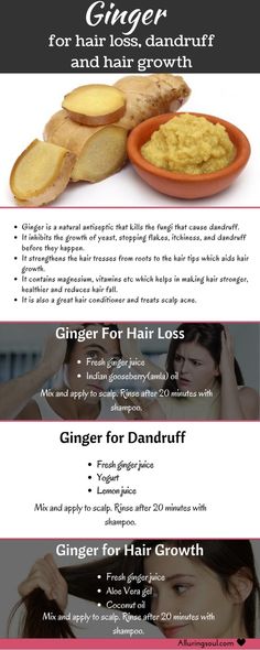 ginger for hair Ginger Remedies, Ginger For Hair Growth, Ginger For Hair, Benefits Of Ginger, Hair Ginger, For Hair Growth, Hair Remedies, Hair Growth Tips, Hair Problems