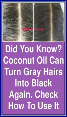 Board name Reverse Gray Hair, Premature Grey Hair, Black And Grey Hair, Pink Board, Coconut Oil For Acne, Hair Care Recipes