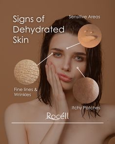 ✨ Signs of Dehydrated Skin 💧  -Fine lines & wrinkles: More pronounced due to lack of moisture     -Sensitive areas: Skin becomes easily irritated    -Itchy patches: Dry, flaky spots that feel uncomfortable     #HydrateYourSkin #DehydratedSkin #SkincareTips Skin Facts, Women Skin, Derma Roller, Skin Clinic, Itchy Skin, Dehydrated Skin, Skin Tips, Skin Concern