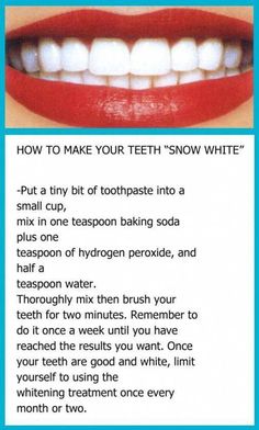 Obličejové Masky, Teeth Whitening Diy, Natural Teeth Whitening, Natural Teeth, Teeth Care, White Teeth, Tooth Decay, Health And Beauty Tips