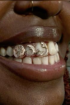 a close up of a person's teeth with braces and gold rings on them