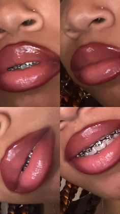 Braces Color Combo Ideas, Brace Color Combos, Pink Braces Aesthetic, Dark Purple Braces, Power Chain Braces Colors, Pretty Lips Aesthetic, Lip Gloss On Lips, Braces Combos