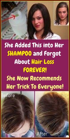 https://www.smore.com/rtq9x Hairloss Remedy Woman, Diy Shampoo Recipe, Baldness Solutions, She Cooks, Homemade Shampoo, Brown Spots On Face, Baking Soda Shampoo, Hair Remedies, Grow Hair