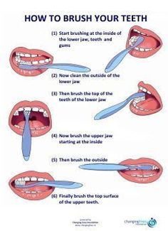 How To Brush Your Teeth #Dentist #Hygienist Sikat Gigi, Dental Facts, Dental Life, Brush Your Teeth