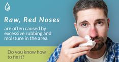 Having a chapped nose is due to many reasons. Chronic rubbing certainly can result in chapping of the nose. And, wetness from a runny nose can also result in a chapped, red, scaly appearance. So, first things first: We've got to figure out a way to fix the root of the problem. Chapped Nose Remedy, Throbbing Headache, Red Rash, Dry Nose, Cold Medicine, Best Lotion, Chest Congestion