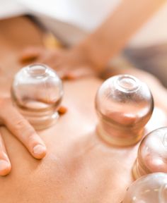 International Cupping Therapy Association - Info, Workshops, Equipment Benefits Of Cupping, Massage Cupping, Health And Wellness Center, Integrative Medicine, Olympic Athletes, Muscle Aches, Deep Tissue Massage