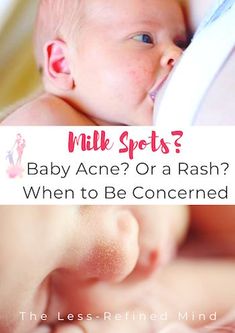 a baby is drinking from a bottle with the caption, milk spots? baby acne or a rash? when to be concerned