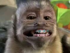 a monkey with braces on it's teeth