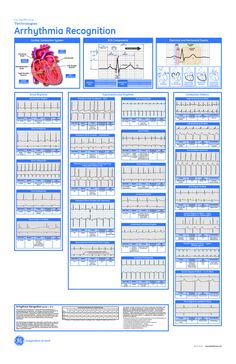 the poster shows an overview of the heart's functions and its corresponding blood vessels