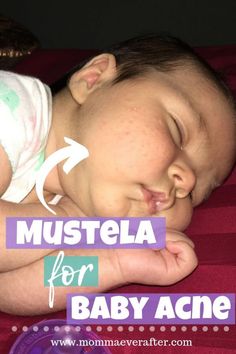 a baby is sleeping with the words mustela for baby acne written on it