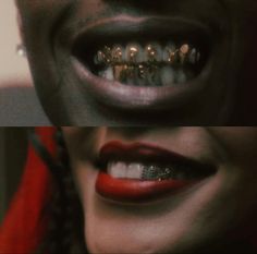 a woman with braces and red lipstick has her mouth open to show the teeth