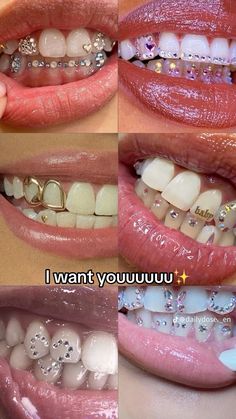 Cute Tooth Gems Ideas, Tooth Gem Ideas Baddie, Girl Grillz Aesthetic, Tooth Gems Black Women, Cute Grills, Teeth Gems Ideas, Grillz For Females, Tooth Gems Aesthetic, Tooth Gem Placement