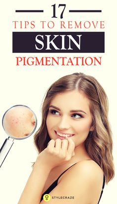 Pigmentation, dark spots, freckles, and an uneven skin tone are a few problems we all face. But then, there are a number of remedies that can solve our problem. In this post, we talk about the top home remedies that can treat skin pigmentation and give you glowing skin. Keep reading! #SkinCare Home Remedies For Skin, Skin Pigmentation, Health Nutrition, Skin Tips, Bad Habits, Uneven Skin