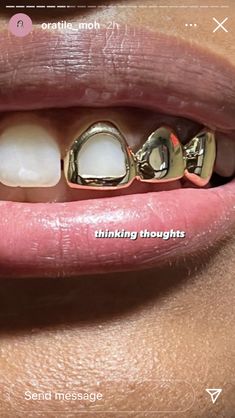 Perfect Teeth, The Bling Ring