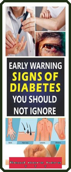 6 SYMPTOMS OF DIABETES  - YOU NEED TO KNOW by Aleksandar Stefanovski | This newsletter was created with Smore, an online tool for creating beautiful newsletters for educators, businesses and more Upset Stomach, Sugar Body, Healthy Tips, Holistic Health, Natural Remedies, Healthy Life