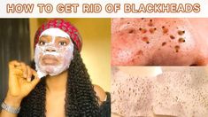 HOW TO REMOVE BLACKHEADS : Egg Mask For Face + How To Get Rid Of BlackheadsHi darlings 🙋🏻‍♀️ In today’s video I will be sharing with you HOW TO REMOVE BLAC... Egg Mask For Face, How To Remove Blackheads, Egg Mask, Mask For Face, Rid Of Blackheads, Blackhead Mask