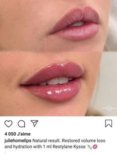 Upturned Lips Corners, Lip Inspiration, Lip Background, Thick Lips, Lips Aesthetic