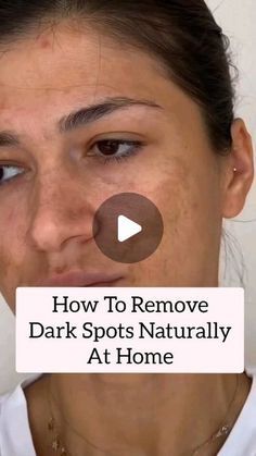 Grooming Tips, Smooth Skin, Dark Spots, Spot On, Home Remedies, Hairstyles