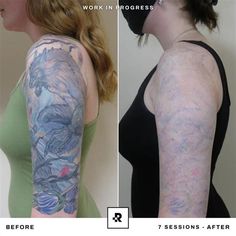 before and after photos of a woman's arm tattoo