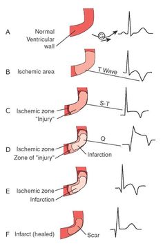 an image of medical diagrams with words written in english and chinese on the same page