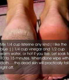 Seriously AWESOME foot peel/softener Cracked Skin, Skin Remedies, Keeping Healthy, Beauty Treatments, Diy Beauty, Keratin