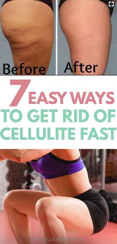 Cottage cheesy legs are not cool, but there are some QUICK, NATURAL HOME REMEDIES TO GET RID OF CELLULITE FAST. Ugly dimplings in the thighs & butt be gone! Saggy Skin, Loose Skin, Do Exercise, Natural Home Remedies, Natural Home, Easy Workouts, Home Remedies, Health Tips, San Diego