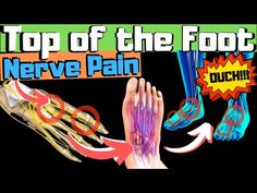 (1253) Sharp, Burning, Tingling Top of Foot Pain? [FIX Your Nerve Pain!] - YouTube Top Of Foot Pain, Heel Pain, On The Top, Fix You