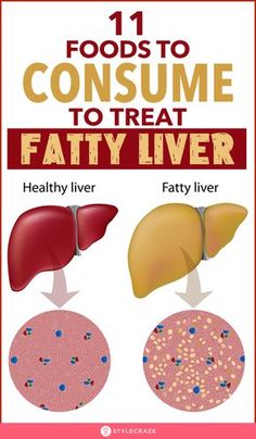 Liver Diet Plan, Healthy Liver Diet, Liver Diet, Makanan Diet, Best Diet Plan, Low Fat Diets, Healthy Liver, Liver Detox, Liver Health