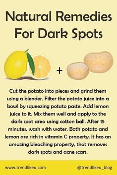 Homemade Skin Care For Dark Spots, Potato Skin Care Dark Spots, Natural Remedies For Dark Spots, Homemade Dark Spot Remover, Potato Face Mask Dark Spots, Natural Face Skin Care For Dark Spots, Fall Facials, How To Remove Dark Spots On Face, Turmeric Face Mask Dark Spots