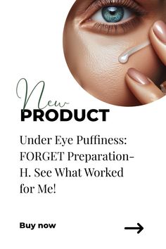 Woman applying eye serum to under eye bags. Preparation H, Eye Puffiness, Under Eye Puffiness, Dark Under Eye, Eye Wrinkle, After Pictures, Natural Beauty Tips