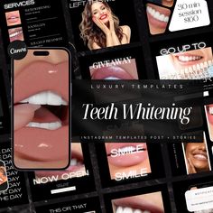 50 Teeth Whitening Instagram Templates | Tooth Gem Instagram Templates | Teeth Whitening Posts | Teeth Whitening Social Media Post Template What you get: 🦷50 Templates 🦷1 PDF with  Canva Link to open the Template (files size: 1080px x 1080px ) 🦷1 PDF with very detailed instructions for how to use canva ( you need an account that is free)  How it Works: 🔥You purchase the template. 🔥 Once Etsy confirms your payment, you can instantly download your PDF. 🔥 You read through the PDF instructions Teeth Whitening Business, Teeth Whitening Professional, V34 Colour Corrector, Colour Corrector, Black Teeth, Small Business Instagram, Whitening Teeth, Dental Marketing, Perfect Teeth