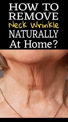 How To Get Rid Of Wrinkles and Spots By Just Using This At Home >>CHECK THIS OUT<< Neck Exercise, Schnitzel Recipes, Get Rid Of Wrinkles, Glow Skincare, Wrinkle Filler