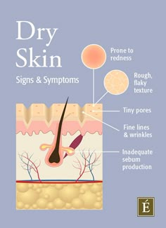 Dryskin Skincare, Dry Skin Causes, Eminence Organic Skin Care, Skin Moles, Skin Care Routine For 20s, Avon Products, Perfectly Posh, Get Even