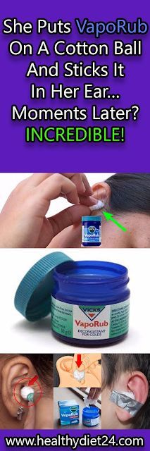 She Puts VapoRub On A Cotton Ball And Sticks It In Her Ear… Moments Later? INCREDIBLE! Cotton Ball, Music Star, Health Remedies, Natural Healing, Herbal Remedies