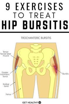 Bursitis Exercises, Best Exercise For Hips, Bursitis Hip, Hip Pain Relief, Lower Back Pain Exercises, Back Pain Exercises, Hip Pain, Hip Workout