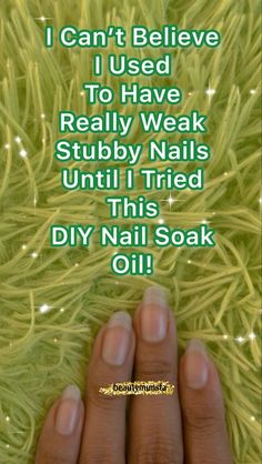 Strong Nails Diy, Long Strong Nails, Grow Long Nails, Nail Strengthening, Nail Growth Tips, Love Nail Art, Nail Care Tips, How To Grow Nails, Shiny Nails