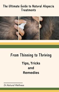 Discover the power of nature in restoring your hair and confidence with The Ultimate Guide to Natural Alopecia Treatments. This comprehensive ebook offers a detailed roadmap to understanding, managing, and treating alopecia using natural and organic remedies. Carpal Tunnel Relief, Therapy Healing, Strength Bracelet, Health Bracelet, Mom Health, Organic Remedy, Healing Therapy, Carpal Tunnel, Magnetic Bracelet